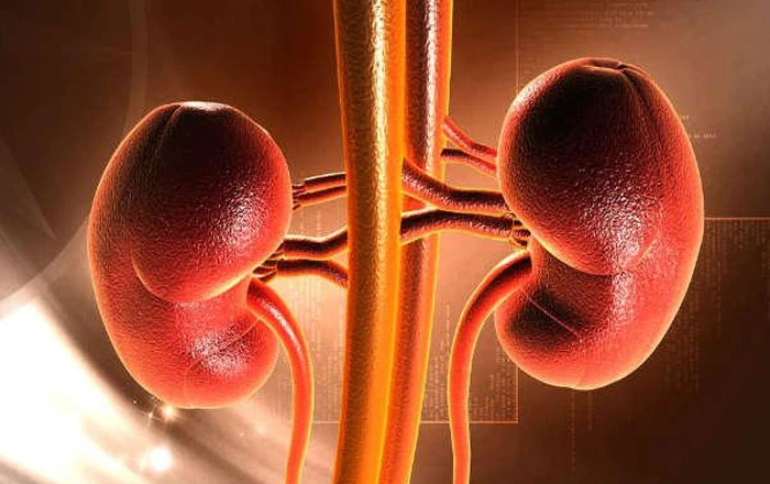 Nephrolithiasis