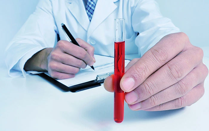 Anemia in CKD